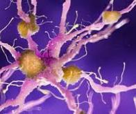 Maladie d’Alzheimer : l’hypothèse d’une cause virale se précise…