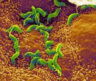 Bactéries et système immunitaire : des liens plus qu'ambigus