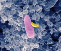 Bactéries multirésistantes : pourquoi ne pas combattre le mal par le mal ?