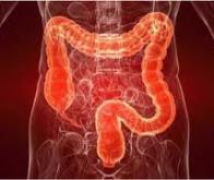 Cancer colorectal : l'intelligence artificielle permet de caractériser les polypes