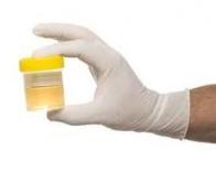 Cancer de la prostate : la détection dans l'urine est possible