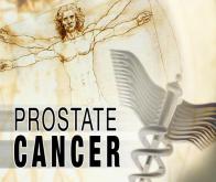 Cancer de la prostate : un gène qui multiplie par vingt le risque !