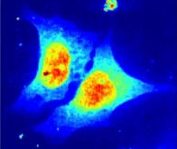 Cancer : des  nanoparticules fluorescentes pour traquer les métastases