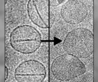 Cancer : des nanocapsules déclenchées par laser…
