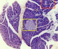 Cancer du pancréas : un  diagnostic précoce grâce à l' imagerie à fluorescence