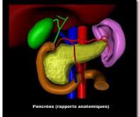 Cancer du pancréas : une nouvelle avancée importante