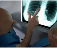 Cancer du poumon : un nouveau mécanisme de développement des tumeurs identifié