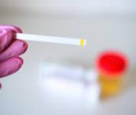 Cancer du rein : un test urinaire pour réduire de moitié les scanners