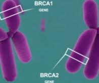 Cancer du sein : le gène BRCA2 cartographié