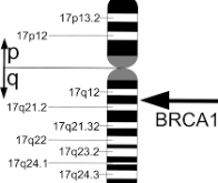 Cancer du sein: le mécanisme génétique d'action du gène BCRA1 enfin compris