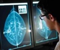 Cancer du sein : une perturbation chronique du rythme circadien augmenterait la dissémination des ...