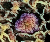 Cancer : Le taux de survie global continue à progresser au Japon