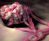 Cancer : les cellules responsables des métastases