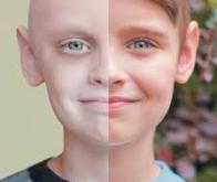 Cancer : les survivants ont un risque accru de maladies tout au long de leur vie