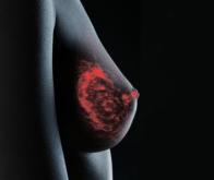 Cancer mammaire : un vaccin associé au létrozole à l’essai chez la souris  