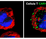 Cancer : un nouveau traitement français basé sur CART-cells