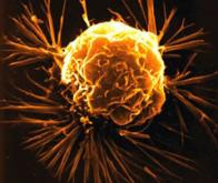Cellules cancéreuses : nouvelles cibles pour l'oxyde de graphène