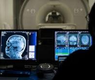 Combiner l’IA et l’IRM pour mieux traiter le cancer