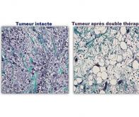 Combiner magnétisme et lumière pour lutter contre le cancer