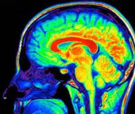 Comment le cerveau traite le flot d’informations sensorielles