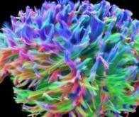 Contre la maladie d’Alzheimer, le cerveau modélisé en 3D à très haute résolution