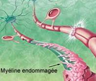 Contrer la perte de myéline pour prévenir le vieillissement cérébral
