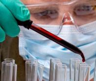 Covid-19 : des chercheurs mettent au point un test sérologique fiable à 99,8 %