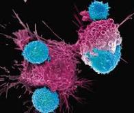 De nouvelles cellules CAR-T permettent de contrôler à la demande le traitement contre le cancer