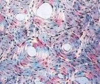 Découverte d'un nouveau mécanisme pour aider à la réparation osseuse