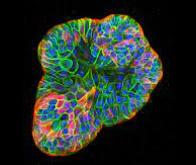 Des chercheurs réussissent à implanter un mini-cerveau humain dans un cerveau de rat…