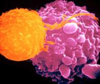 Des chercheurs transforment des cellules cancéreuses en cellules tueuses de cancer !
