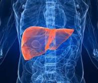 Des microsphères radioactives dans le poignet pour lutter contre le cancer du foie