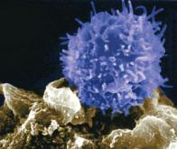 Des molécules conçues pour stimuler les cellules immunitaires contre le neuroblastome