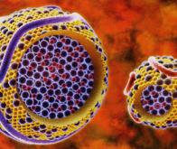 Des nanoparticules thérapeutiques à double détente