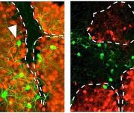 Des neurones reprogrammés in vivo