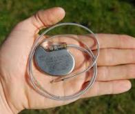 Des pacemakers pour lutter contre les apnées du sommeil