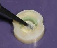 Des revêtements en verre bioactifs pour la fabrication d’implants osseux
