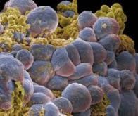 Désorganiser les cellules cancéreuses pour mieux les combattre
