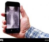 Détecter une maladie à partir d'un simple scan de smartphone