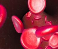 Drépanocytose : vers une thérapie génique 