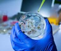 Antibiorésistance : un défi scientifique mondial pour notre siècle...