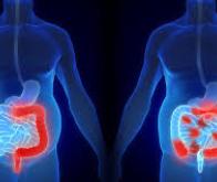 Face à la maladie de Crohn, une molécule conçue par l'IA réinvente les antibiotiques