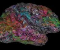 Identification d'une aire cérébrale responsable d’un puissant biais cognitif