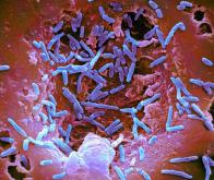 La bactérie du microbiote qui pourrait éliminer  la maladie de Parkinson