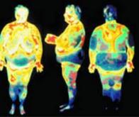 La graisse du ventre augmente le risque de mortalité