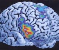 La mémoire associative indirecte : un mécanisme cérébral identifié