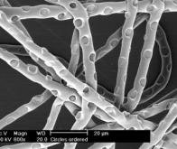 La nano impression lithographique au service des cellules-souches