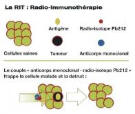 La radio-immunothérapie alpha : une arme à double détente contre le cancer