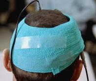 La stimulation cérébrale non-invasive améliore l'apprentissage moteur