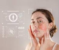 La technologie d'IA multimodale augmente la détection précoce des affections cutanées